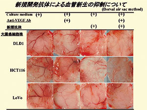 大腸がん細胞株